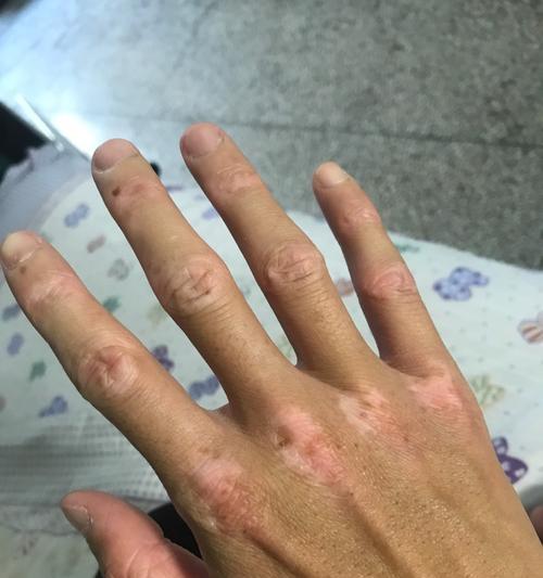 篮球防守技巧之扒拉手，让你轻松盯死对手（掌握扒拉手技巧，提高篮球防守效果）